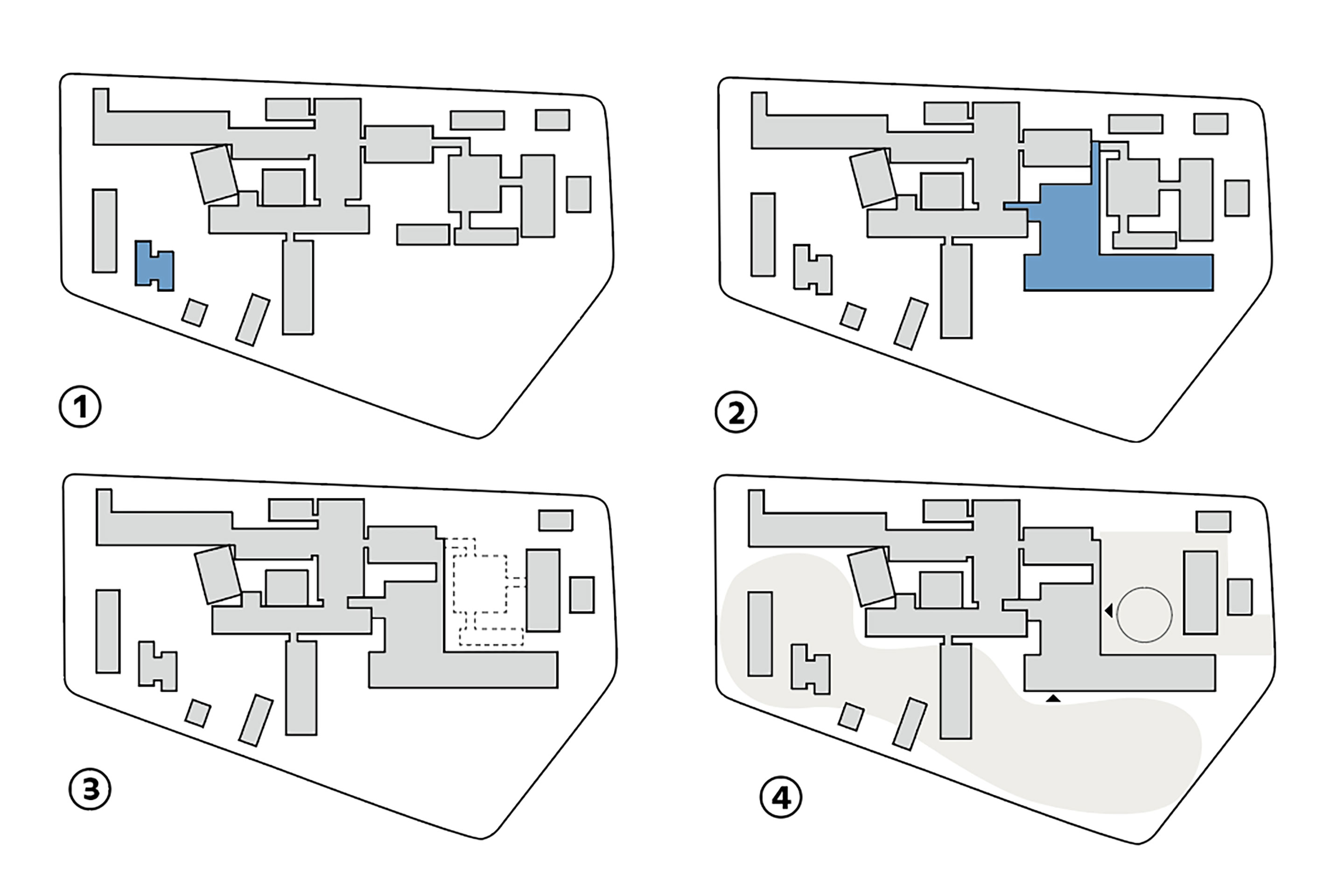 Arealumbau in Etappen: 1. Bau Pavillon Radio-Onkologie;  2. Ersatzneubau «Didymos»; 3. Rückbau Hochhaus; 4. Platz und Park.